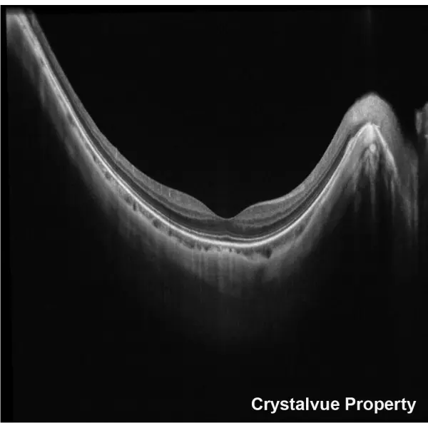 OCT Crystalvue VISION-700 (6).webp
