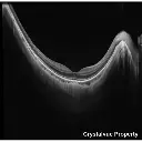 OCT Crystalvue VISION-700 (6).webp