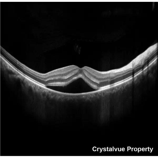 OCT Crystalvue VISION-700 (7).webp