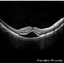 OCT Crystalvue VISION-700 (7).webp