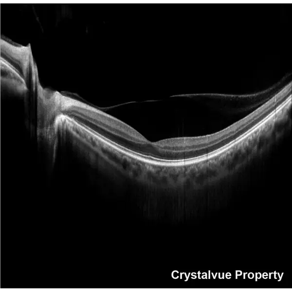 OCT Crystalvue VISION-700 (8).webp
