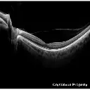 OCT Crystalvue VISION-700 (8).webp