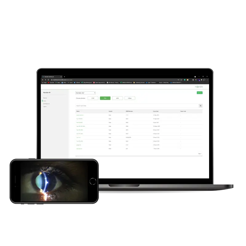 LAF_portable_slit_lamp-PSL D20 2.webp