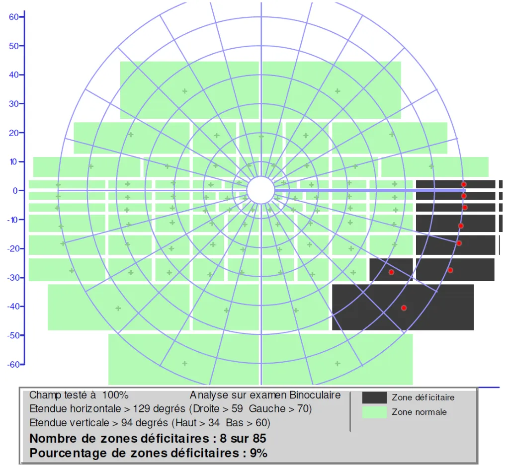 Esterman Taux incapacité.webp