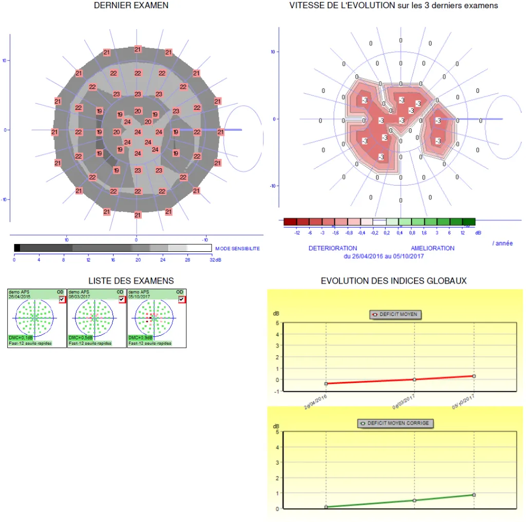 CV suivi evolution APS.webp