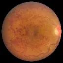 FOP_eye_fundus7.webp