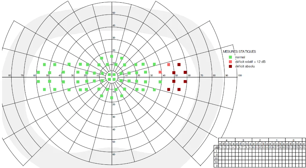 Aptitudes à la conduite.webp