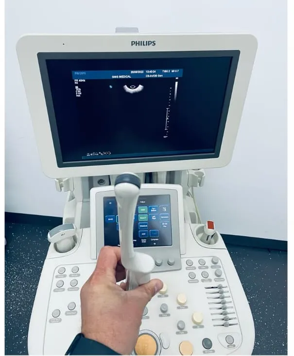 Échographe Philips iU22