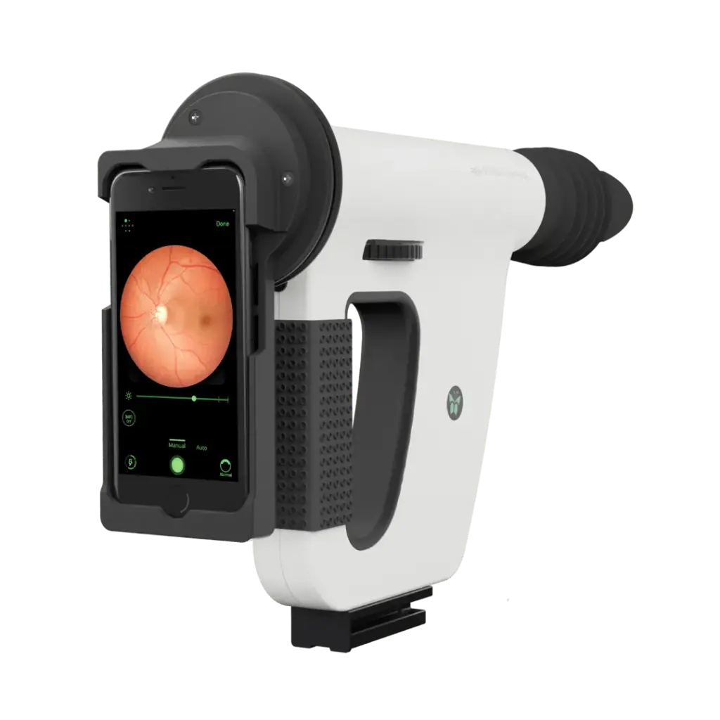 Rétinographe portable Remidio FOP NM-10