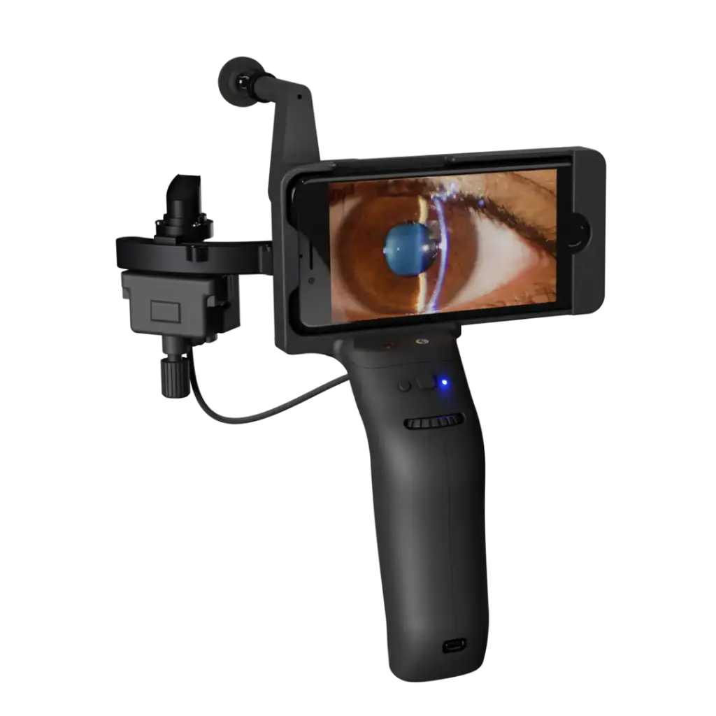 Lampe à fente portable Remidio PSL D20