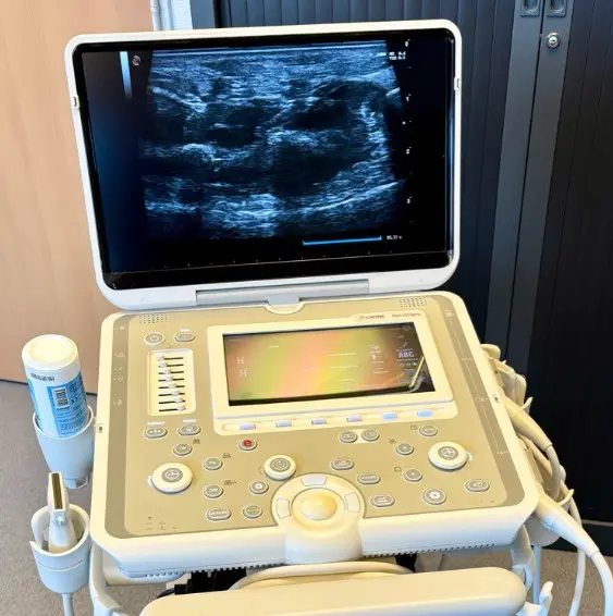 Échographe portable ESAOTE MyLab (2023)